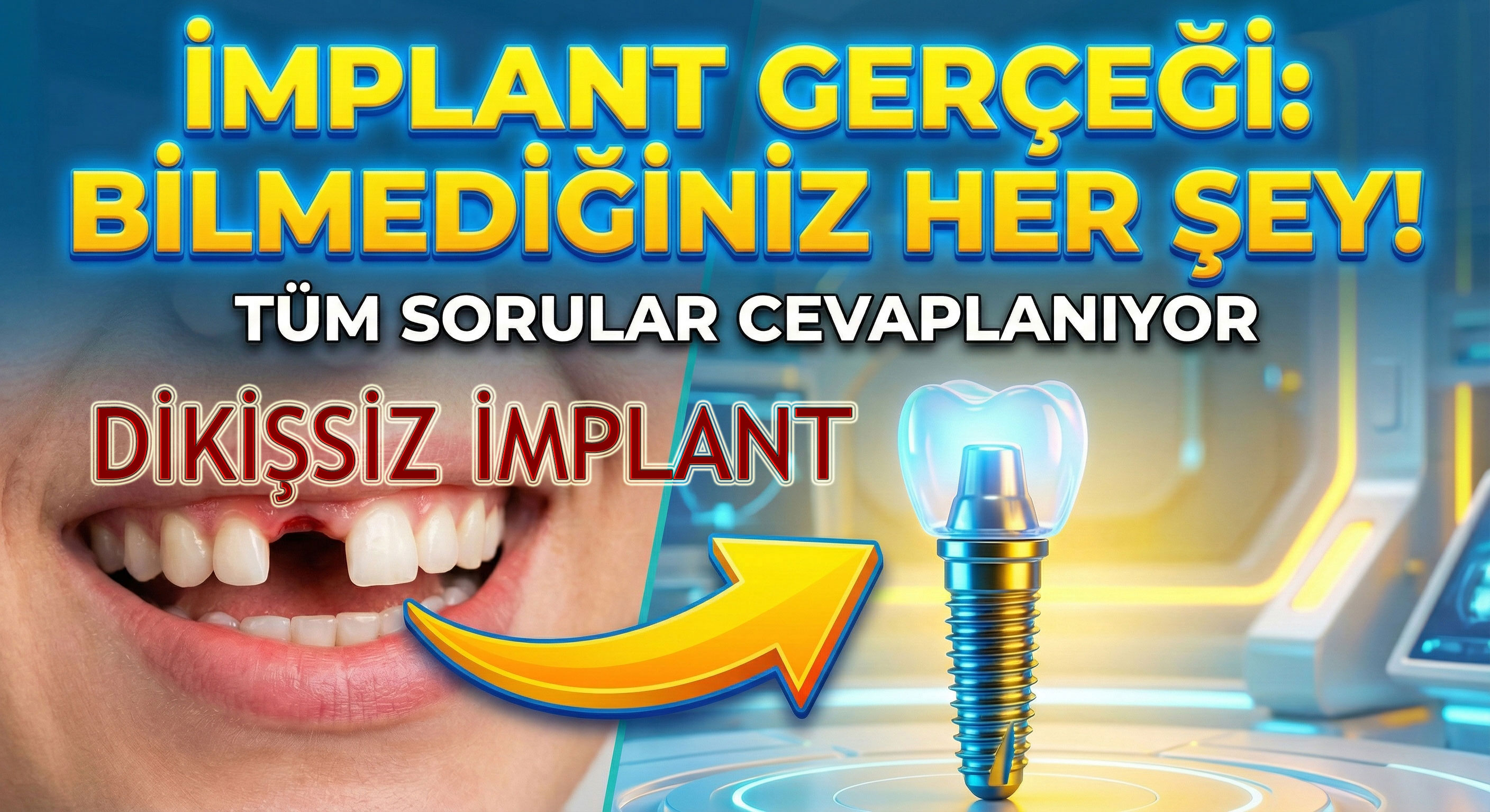 Küçükçekmece Diş İmplantı Tedavisi ve Fiyatları